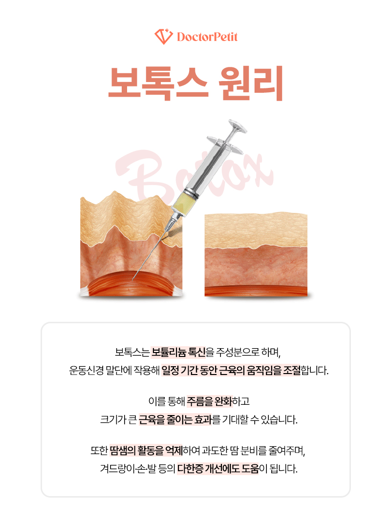 구월동침샘보톡스 부작용 피하고 싶다면 2가지를 꼭 기억하세요