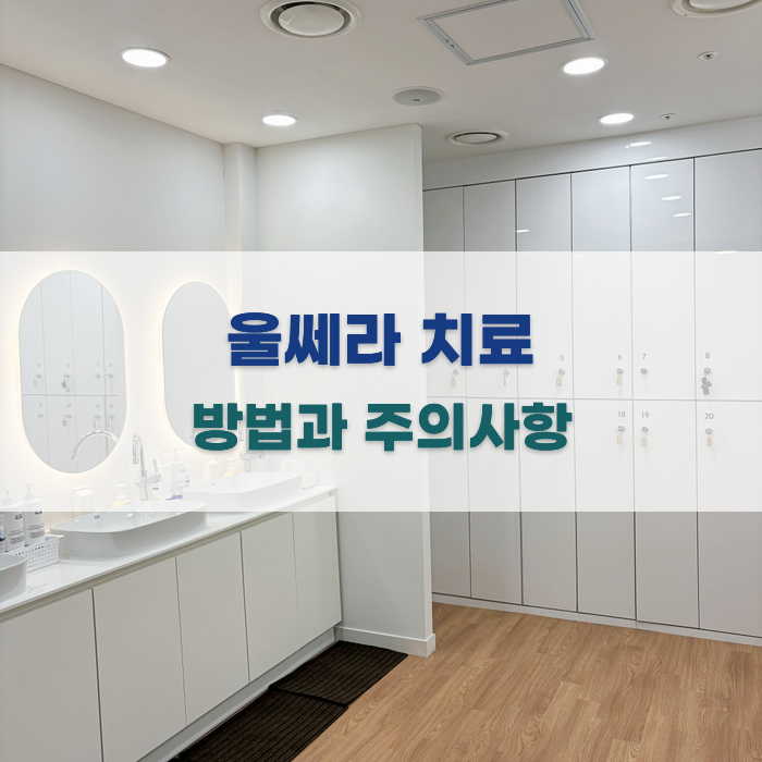 울쎄라 치료 방법과 주의사항